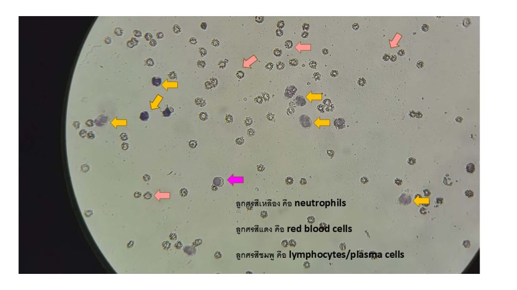 Blood Morphology2