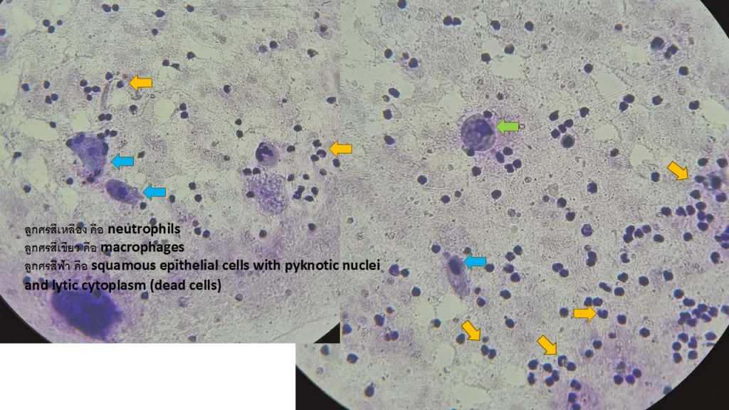Blood Morphology3