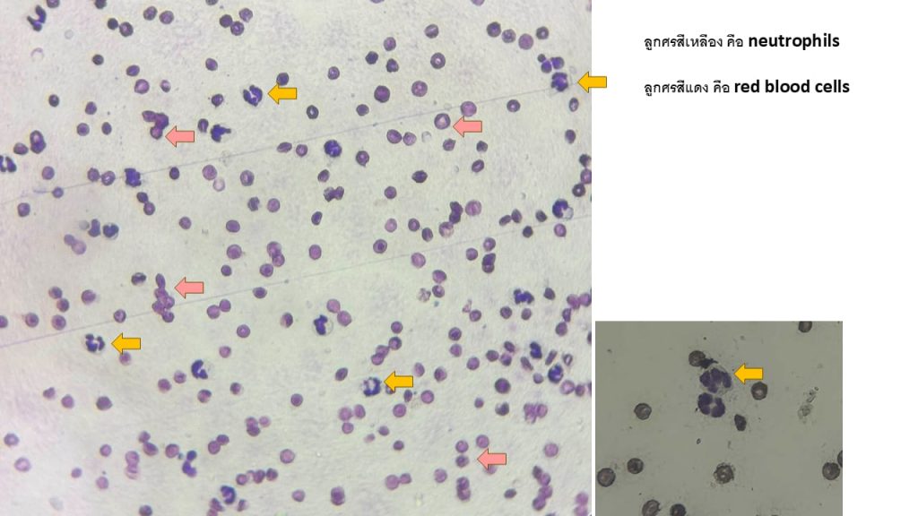 Blood Morphology4